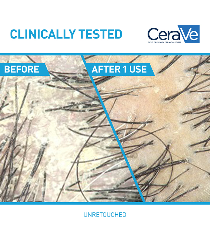 cerave-antidandruffhydratingshampoo-12oz-us-clinicals_1_700x785_v1.jpg